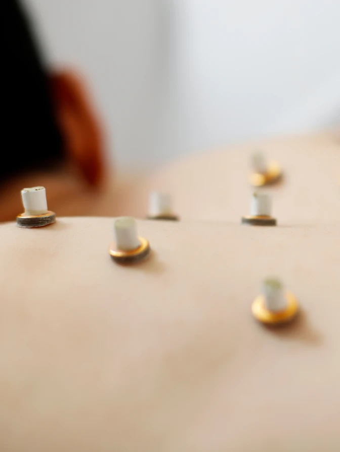 치유본 교통사고 전자뜸치료